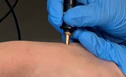 bioenergetic testing stylus on skin