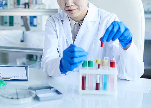 lady analyzing samples for high reticulocyte count