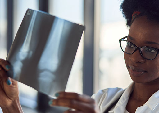 femme afro-américaine examinant une radiographie lors d'un test de densité minérale osseuse