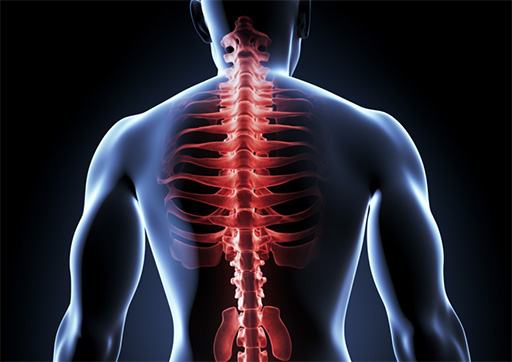 illustration of misaligned spine impacting nerves