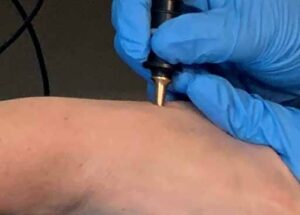 bioenergetic testing stylus on skin